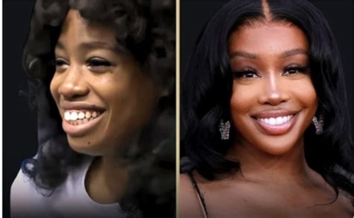 A Guide For SZA Before Surgery