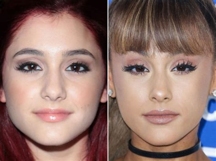 Ariana Madix Makeup Guide: Nose Job Before And After Photos