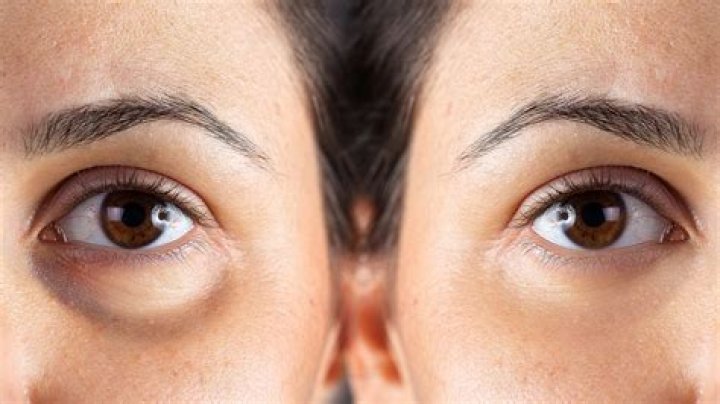 Eight Saints Eye Cream Could Make a Difference in Just 3 Days |