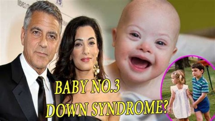 Ella Clooney's Journey With Down Syndrome: Unlocking Potential