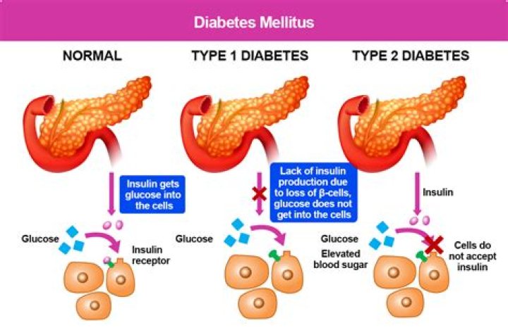 Ep.15 Type 1 Diabetes with Andrew Berger You Cured What?!