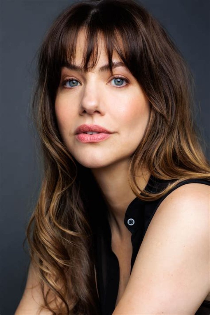 Julie Gonzalo's Face Scar Explored