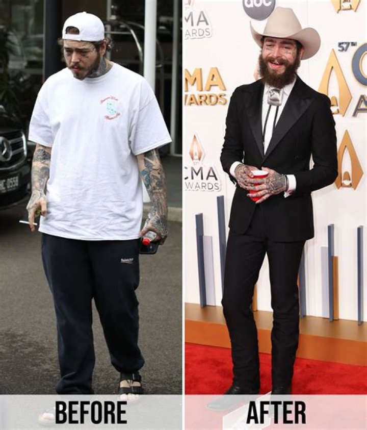Post Malone's Weight Loss Journey: Tips And Transformation