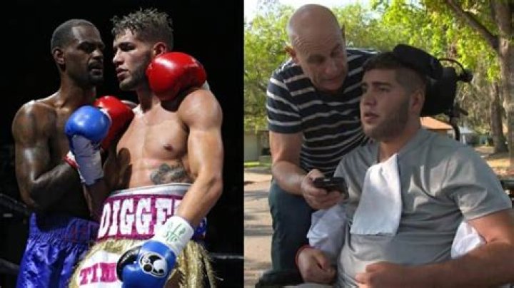 Prichard Colon Before And After: A Transformation Story