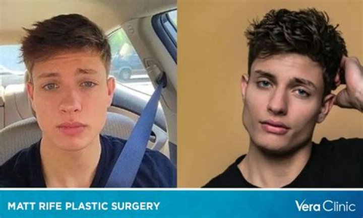 Unraveling Matt Rife's Height And Weight: Secrets And Surprises Revealed