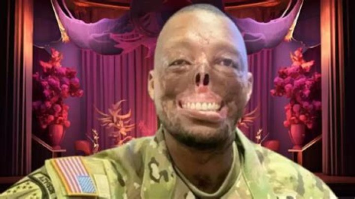 Unraveling The Truth Behind Randy Adams' Face Accident: Insights And Revelations