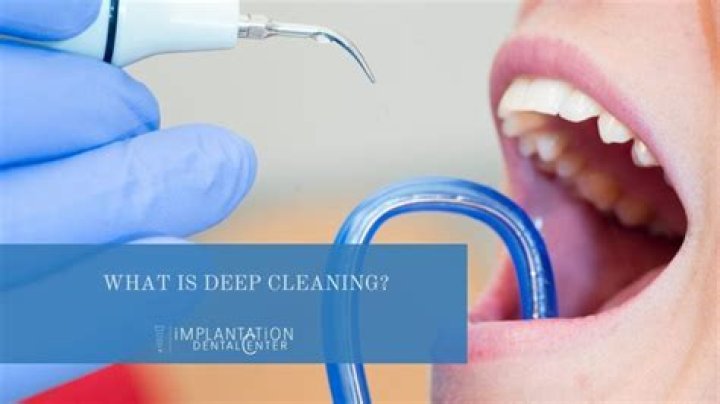 Unveiling The Secrets Of Captain Jason's Unforgettable Teeth: A Dental Deep Dive