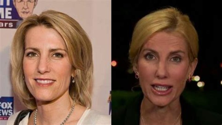 Unveiling The Secrets Of Laura Ingraham's Plastic Surgery Journey |