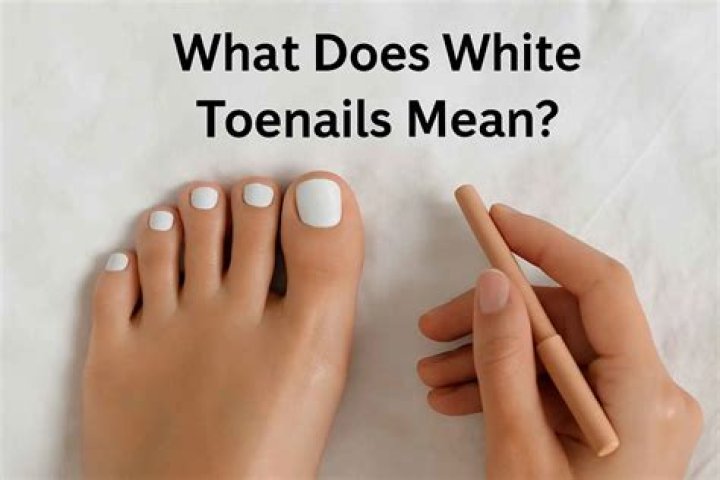 What Do White Toes Mean