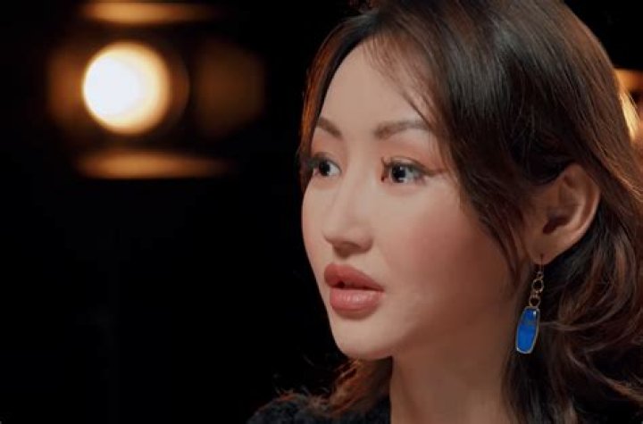 Yeonmi Park's Plastic Surgery Journey And The Transformative Power Of Transformation